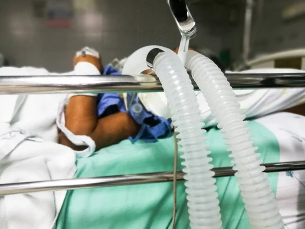 Ademhalingsapparatuur voor buis in Icu — Stockfoto