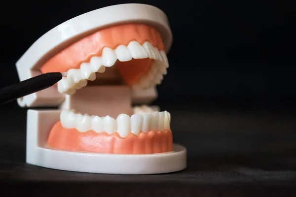 Długopis Dentysty Zębów Trzonowych Modelu Anatomii Szczęki Izolowane Czarnym Tle — Zdjęcie stockowe