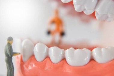 Minyatür insanlar diş temizleme işini sağlık ve sağlık hizmeti olarak görüyor. Diş bakımı veya diş hekimi temizleme fikri.