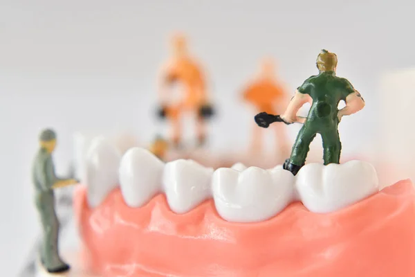 Miniatura Pessoas Trabalhador Limpeza Modelo Dentário Como Médicos Saúde Idéia — Fotografia de Stock