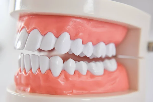 Close Dentes Modelo Acrílico Mandíbula Humana Para Estudar Higiene Oral — Fotografia de Stock