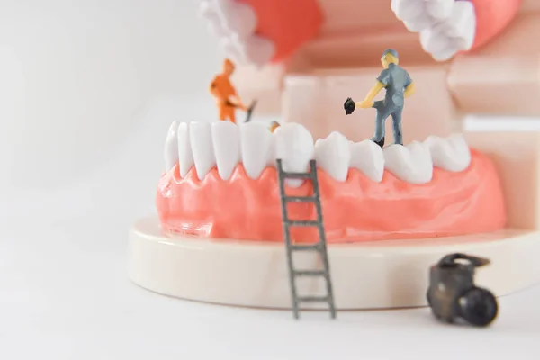 Pessoas Miniatura Para Reparar Dente Trabalhador Limpeza Modelo Dentário Como — Fotografia de Stock