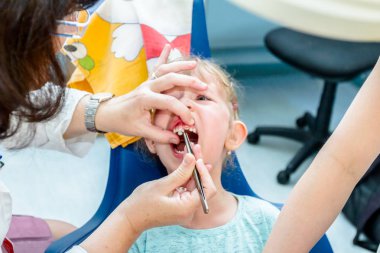 Açık ağız, diş hekimi, diş ile korkmuş tatlı küçük kız 