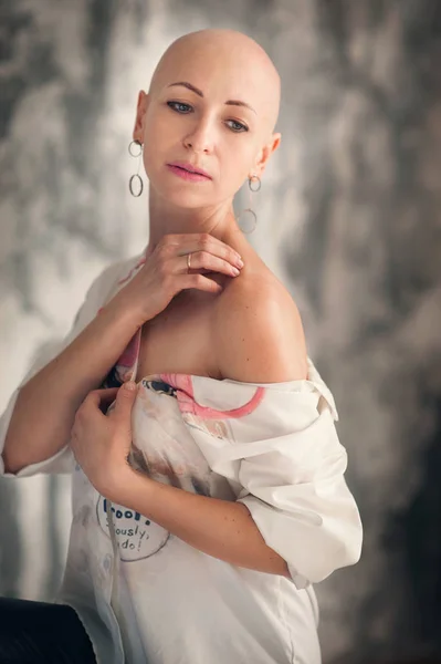 Ritratto Bella Paziente Mezza Donna Con Cancro Alla Testa Rasata — Foto Stock