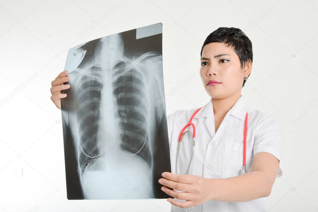 Asian doctor examining a lung radiography