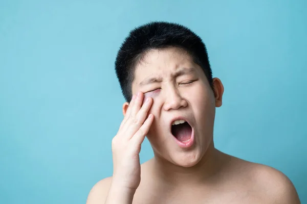 Eye Asian Preteen Boy Bruising Eye Domestic Violence Bully Concept — Stock Photo, Image