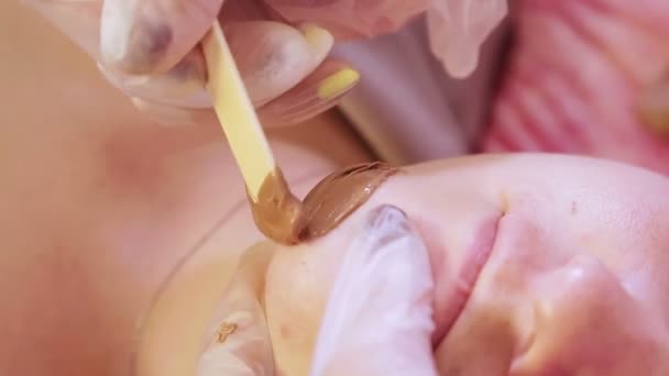 Косметолог наносит горячий воск с лопаткой на лицо морщин — стоковое видео
