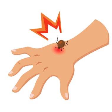 Beyaz arka plan üzerinde izole el ensefalit kene ısırıkları