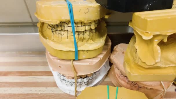 Moldes Dentários Próteses Modelo Gesso Madeira Tecnologia Dentistry — Vídeo de Stock