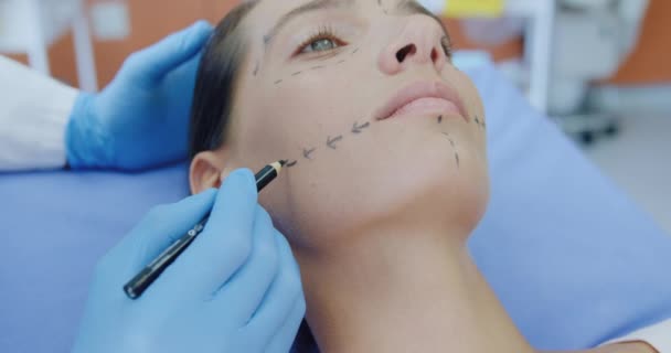 一位白种人病人躺在诊所的手术台上 一位美容师用铅笔慢慢地在她的脸上做记号 侧视近视 — 图库视频影像