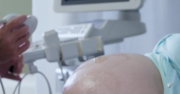 Vue Latérale Une Femme Enceinte Caucasienne Recevant Balayage Ultra Sonore — Video