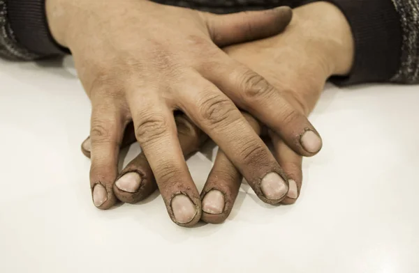 Mãos de homem sujas — Fotografia de Stock