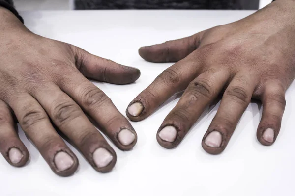 Mãos de homem sujas — Fotografia de Stock