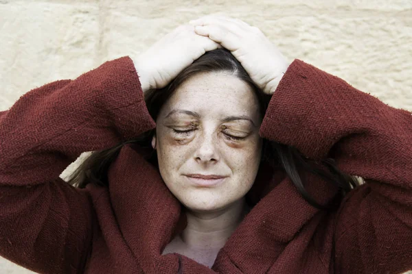 Woman with bruised eyes — Stock Photo, Image