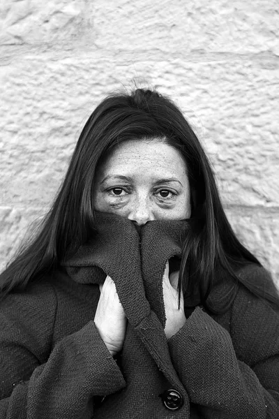 Woman with bruised eyes — Stock Photo, Image