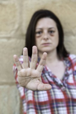 Çürük gözlü kadın