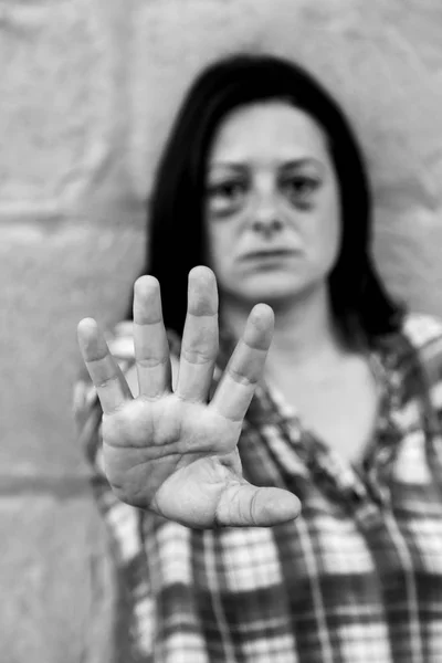 Mujer con los ojos magullados — Foto de Stock