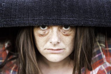 Çürük gözlü kadın