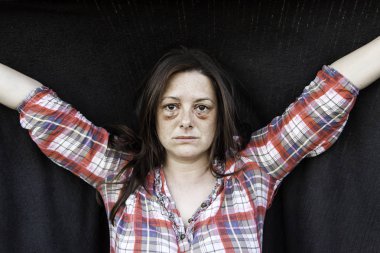 Çürük gözlü kadın