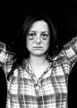 Çürük gözlü kadın