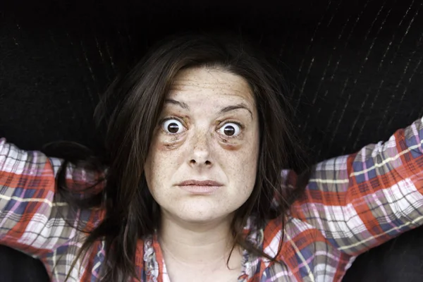 Mujer con los ojos magullados — Foto de Stock