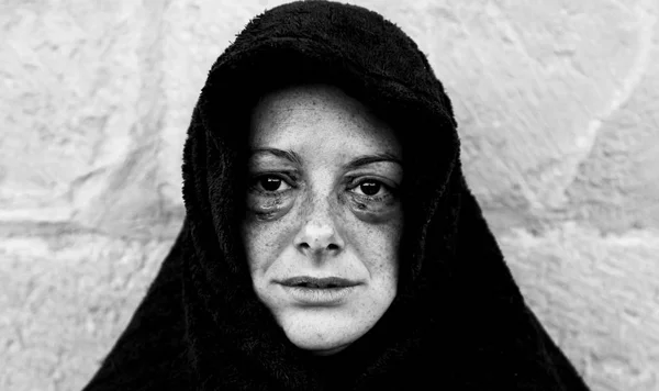 Mujer con los ojos magullados — Foto de Stock