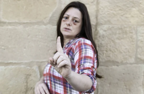 Woman with bruised eyes — Stock Photo, Image