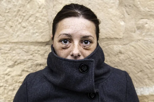 Mulher com olhos machucados — Fotografia de Stock