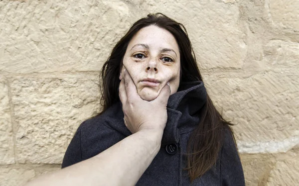 Vrouw met gekneusd ogen — Stockfoto
