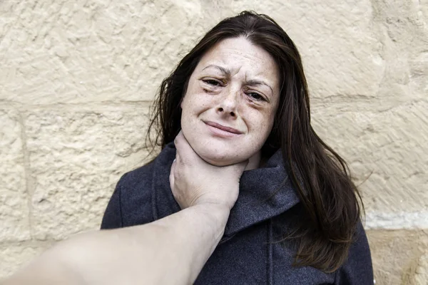 Woman with bruised eyes — Stock Photo, Image