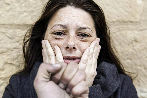 Woman with bruised eyes — Stock Photo, Image