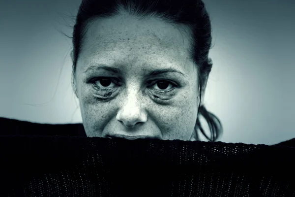Battered woman with eyes damaged — Stock Photo, Image