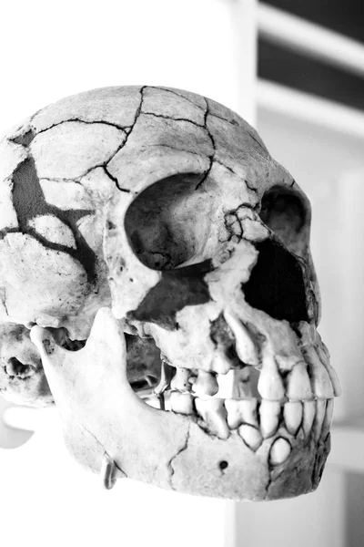 Cabeça de crânio humano — Fotografia de Stock