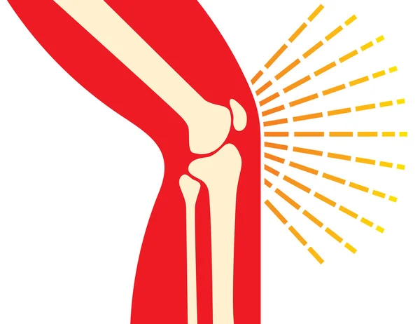 Кістки колінного суглоба - значок болю — стоковий вектор