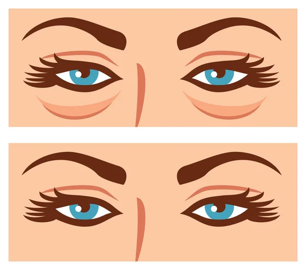 Kobieta oczy przed i po ilustracji wektorowych zabieg kosmetyczny (Chirurgia plastyczna, zabiegi odmładzające) — Wektor stockowy
