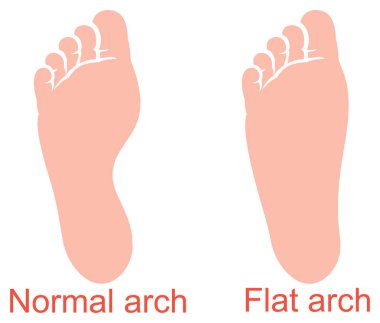 insan anatomisi - düz ve normal kemer vektör çizim