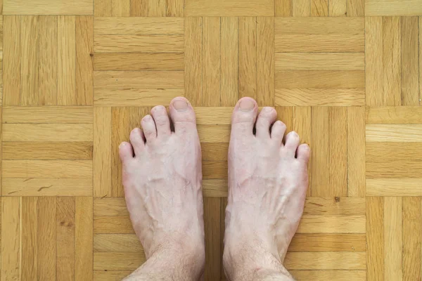 Caucasico maschio piedi nudi con dito storto punta in piedi su woo — Foto Stock