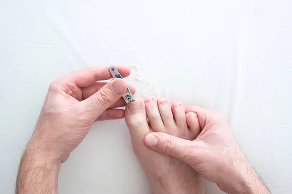 Caucasiano Masculino Mão Cortando Suas Unhas Dos Pés Com Cortador — Fotografia de Stock