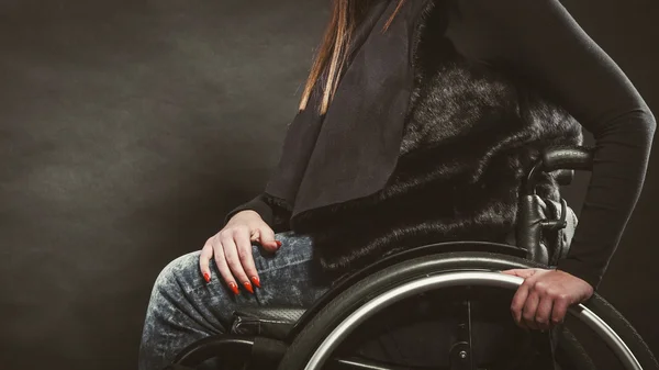 Pernas da pessoa com deficiência . — Fotografia de Stock