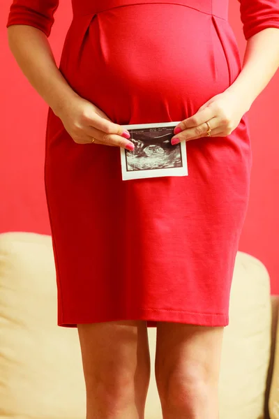 妊娠中の女性とスキャンのクローズ アップおなか — ストック写真