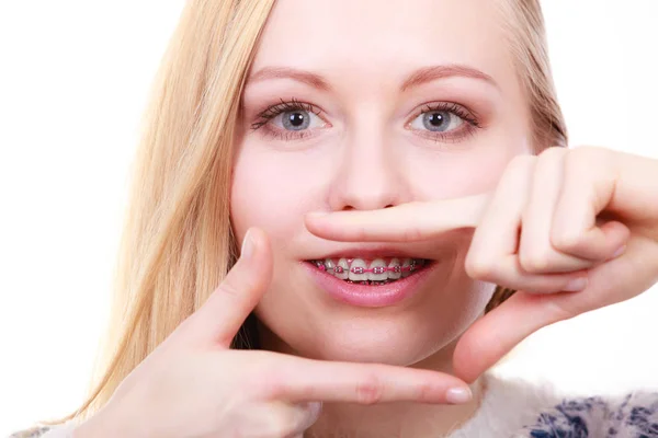 Donna felice mostrando i suoi bretelle sui denti — Foto Stock