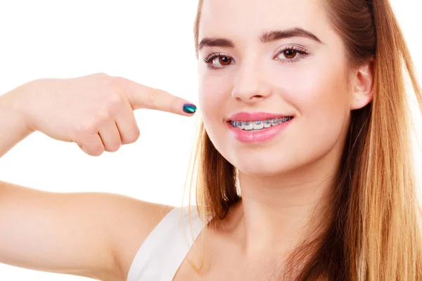 Mujer mostrando sus dientes con aparatos ortopédicos —  Fotos de Stock