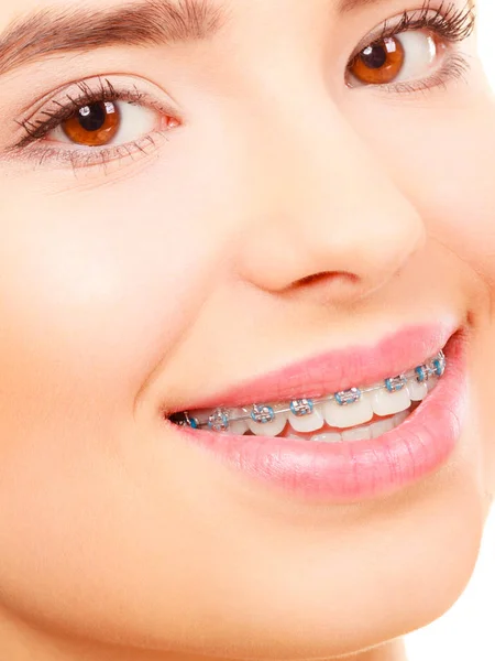 Žena s úsměvem zobrazeno zuby s kšandami — Stock fotografie