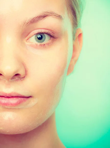 Woman in facial peel off mask. — Stock Photo, Image