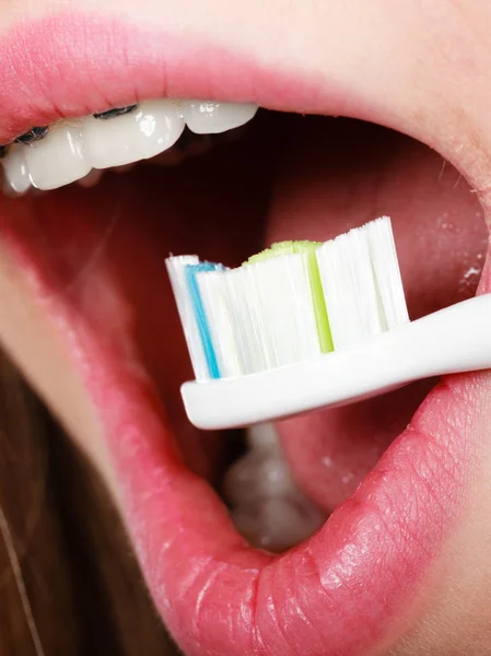 Frau putzt Zähne mit Zahnspange mit Bürste — Stockfoto