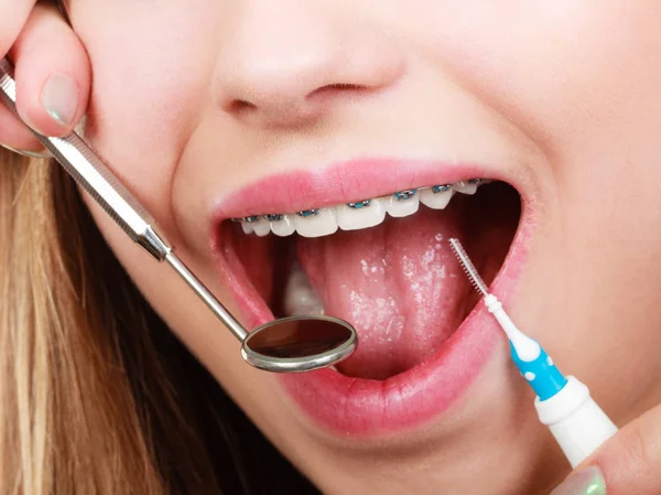 Wanita dengan kawat gigi memiliki janji dengan dokter gigi — Stok Foto