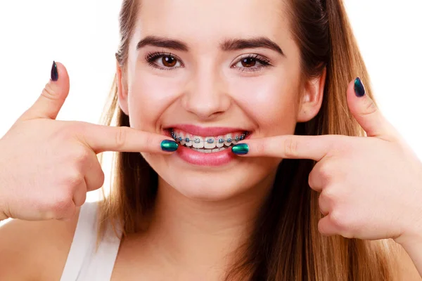 Mujer mostrando sus dientes con aparatos ortopédicos — Foto de Stock