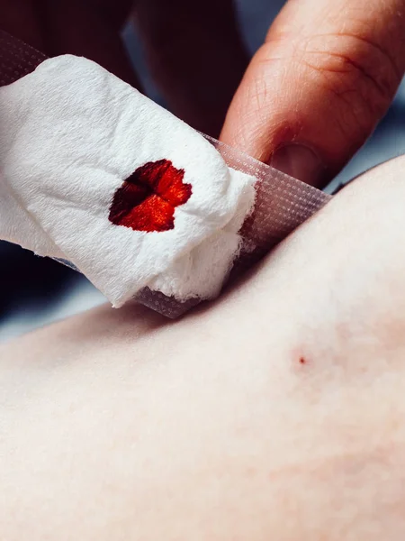 Primo piano della benda sul braccio dopo aver preso un campione di sangue — Foto Stock