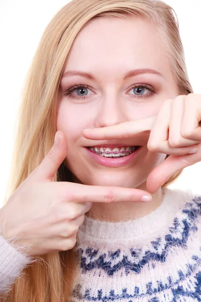 Donna felice mostrando i suoi bretelle sui denti — Foto Stock