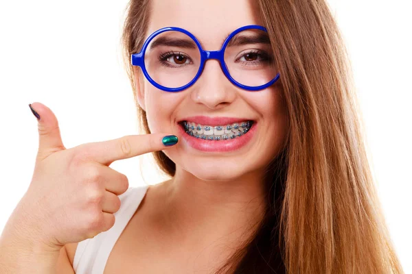 Nerdy mulher mostrando seus dentes com aparelho — Fotografia de Stock